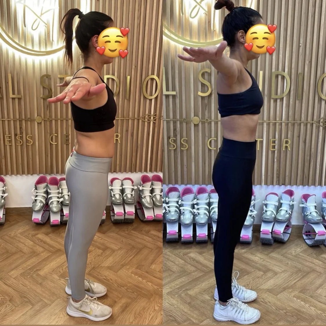 תמונת לפני ואחרי – תוצאה 20